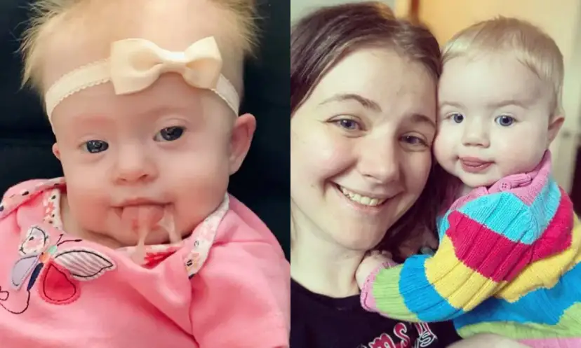 Czy urodzić dziecko z zespołem Downa? Ważne ryzyka i decyzje