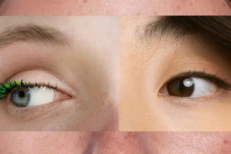 Rozjaśnij cerę: Skuteczne metody na przebarwienia i równy koloryt