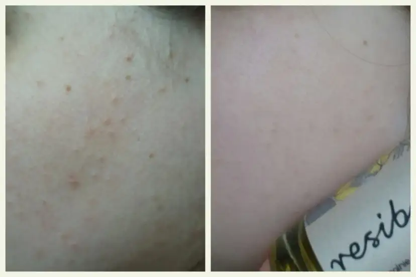 Resibo Kontrola Sebum: Czy to serum rozwiąże Twoje problemy z cerą?