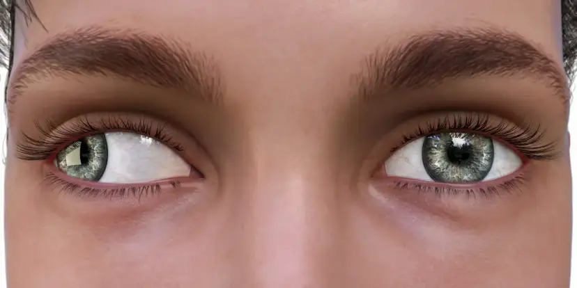 Zez: Czy da się wyleczyć? Skuteczne metody i szanse na proste oczy