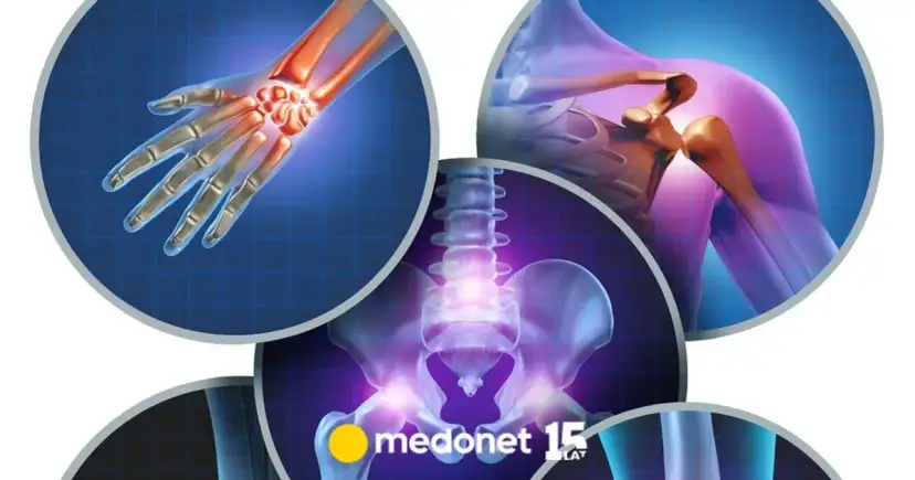 Movalis lek na co? Poznaj skuteczne zastosowania i działanie