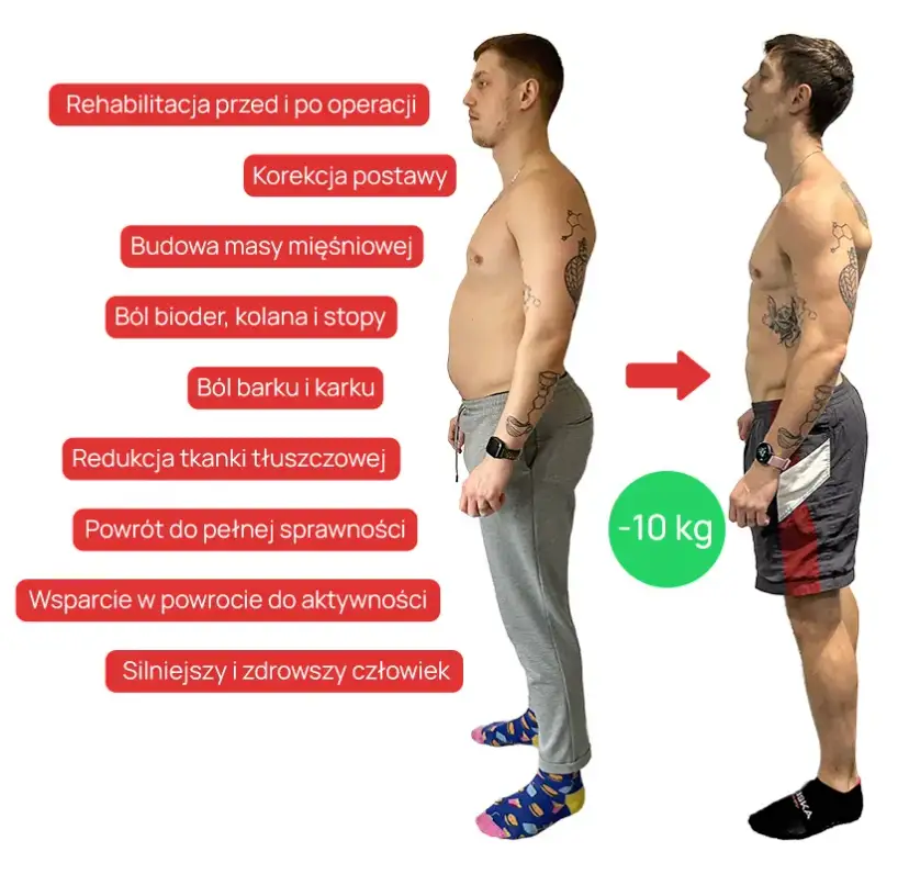 Kiedy rehabilitacja przynosi efekty? Realne ramy czasowe