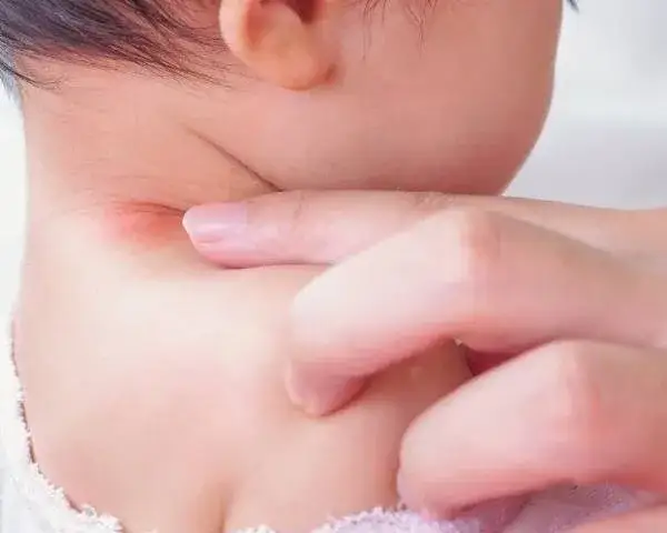 Co to jest AZS u dziecka? Objawy, przyczyny i skuteczne leczenie