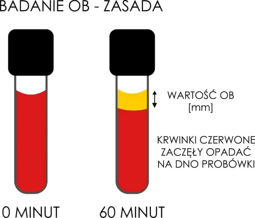 Skrzep w próbce krwi: Błąd czy choroba? Zrozum swój wynik
