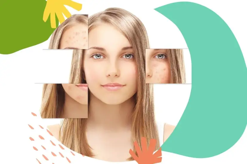 Twarz młodej kobiety z widocznymi fragmentami skóry z niedoskonałościami.