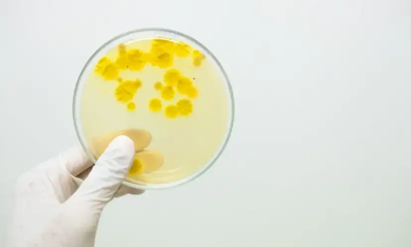 Liczne bakterie w moczu: Kiedy to problem? Interpretacja i leczenie