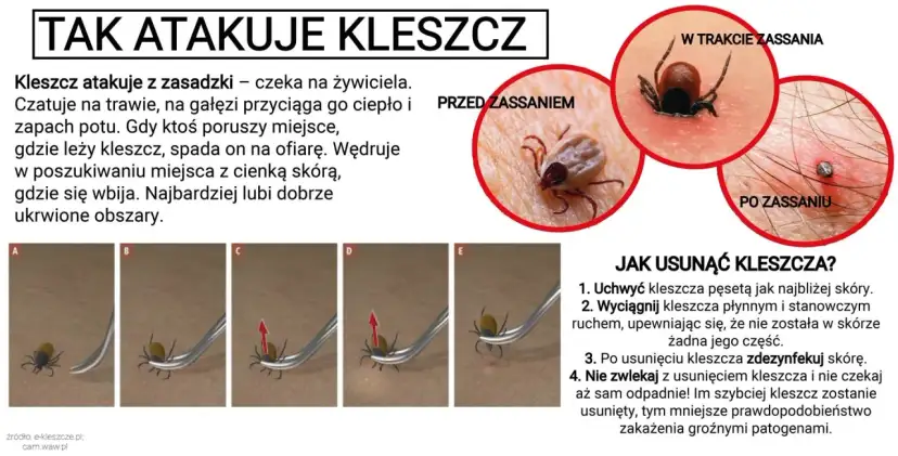 Kleszcz pod skórą to mit! Jak rozpoznać i bezpiecznie usunąć?