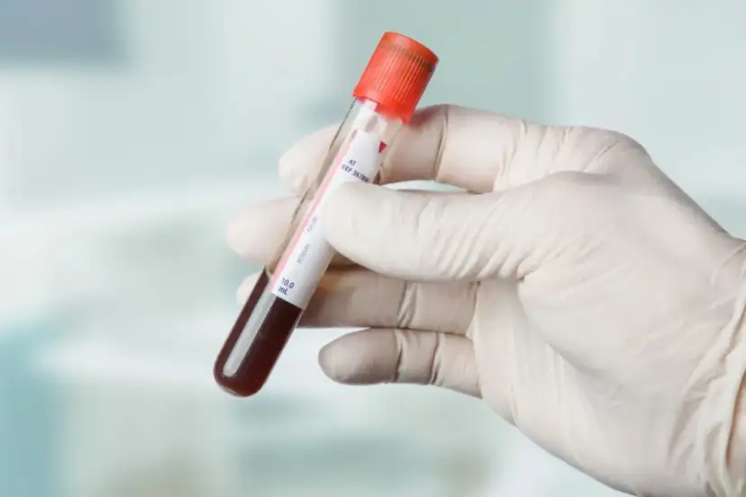 TSH: Co to za badanie? Czy Twoja tarczyca działa prawidłowo?