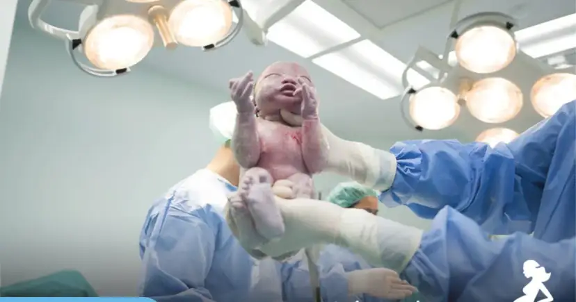 3 cesarka: kiedy jest planowana i co musisz wiedzieć