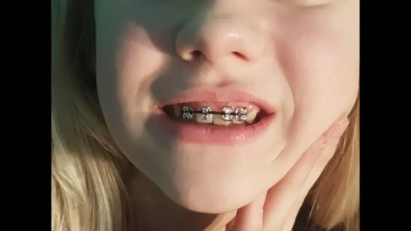 DIY sztuczny aparat na zęby: Jak zrobić bezpieczny rekwizyt?