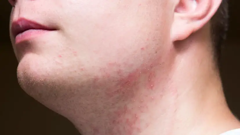 Czym golić twarz, aby uniknąć podrażnień i uzyskać gładką skórę