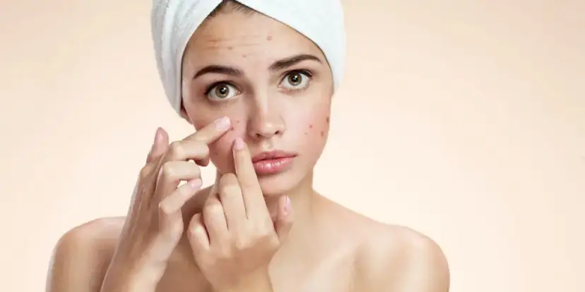 Pryszcz, który nie znika – co może oznaczać i jak leczyć?