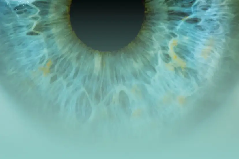 Jak długo trwa rehabilitacja po operacji jaskry? Poznaj ważne informacje