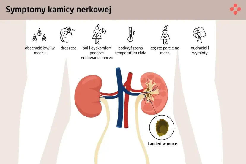 Diagnostyka kamicy nerkowej: Jakie badania i co oznaczają?