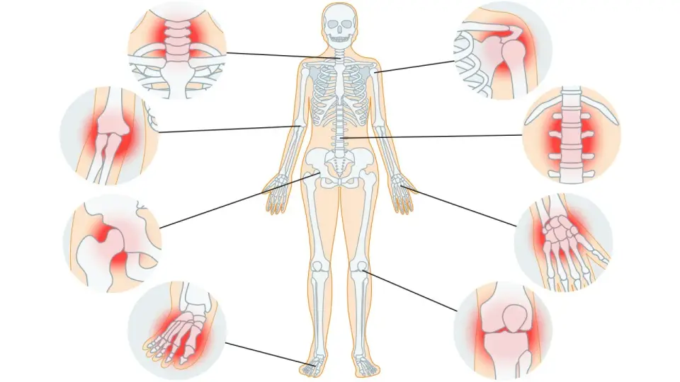 Arthrose heilen ist nicht einfach - was wirklich hilft