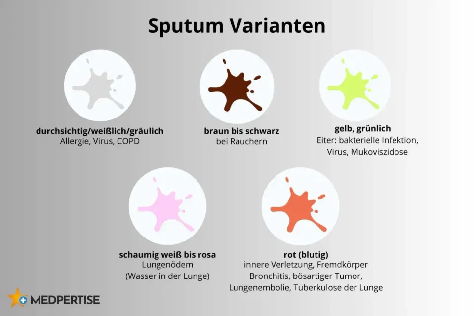 Gelb verfärbter Auswurf - was er bedeutet und wann Arzt nötig ist