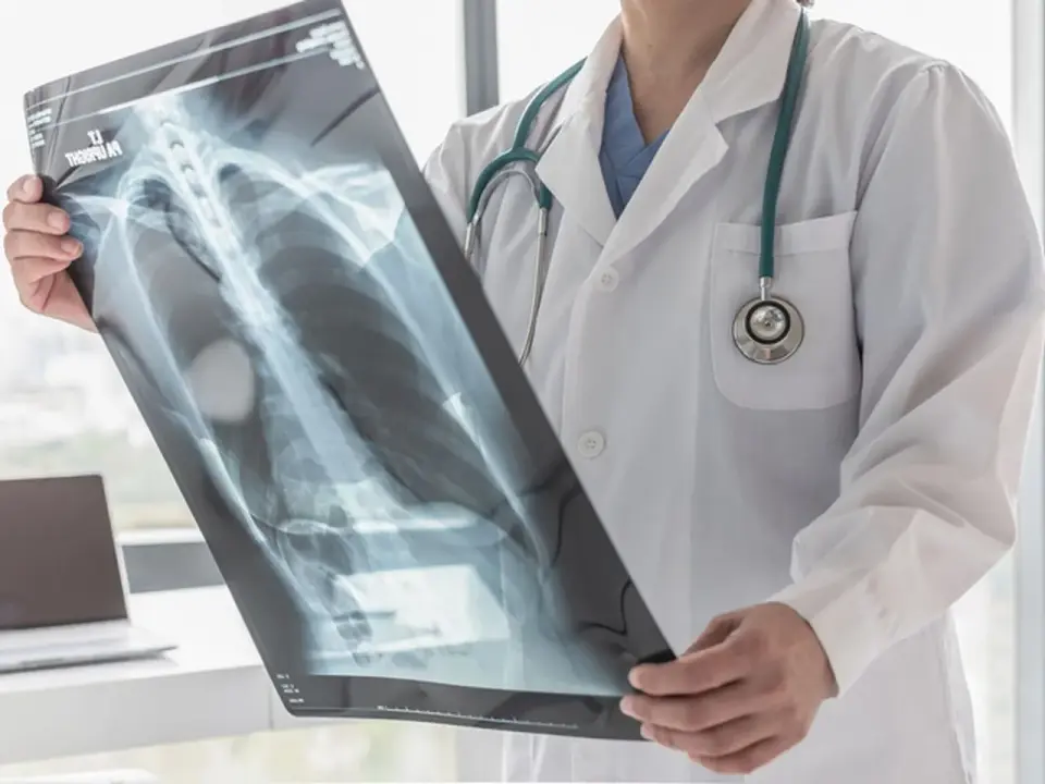 Klatka piersiowa (thorax): budowa, funkcje i narządy w środku