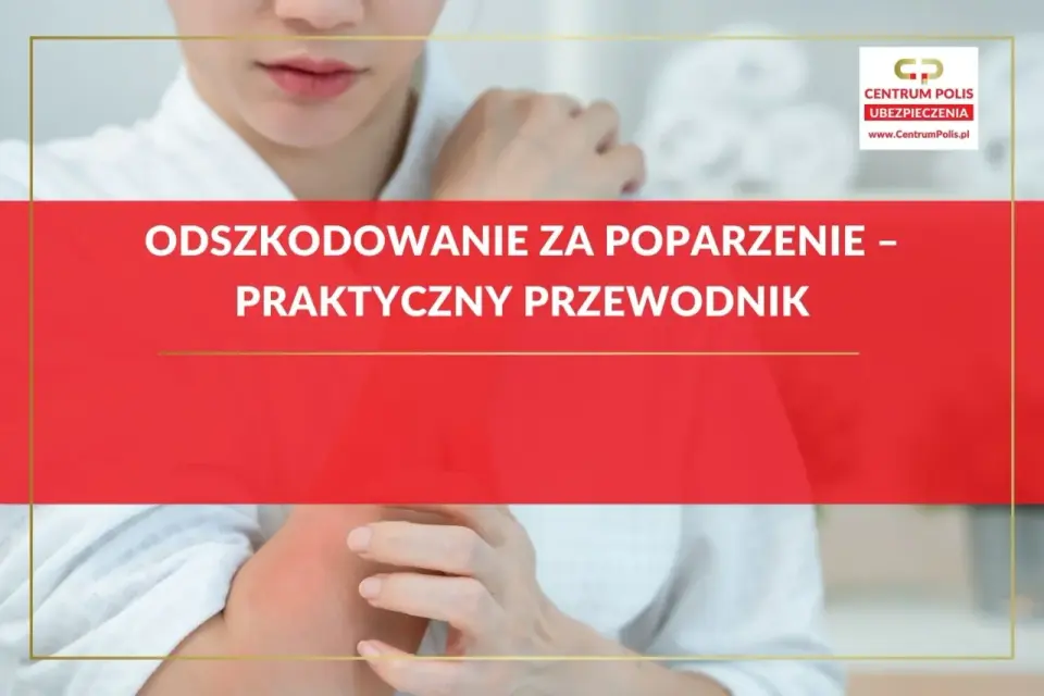 Odszkodowanie za oparzenie - Jak uzyskać pełną kwotę?