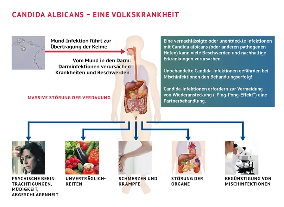 Candida-Behandlung - Symptome, Nebenwirkungen oder Warnsignal?