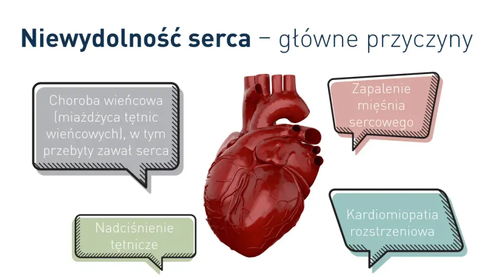 Niewydolność serca - objawy, badania i co naprawdę pomaga