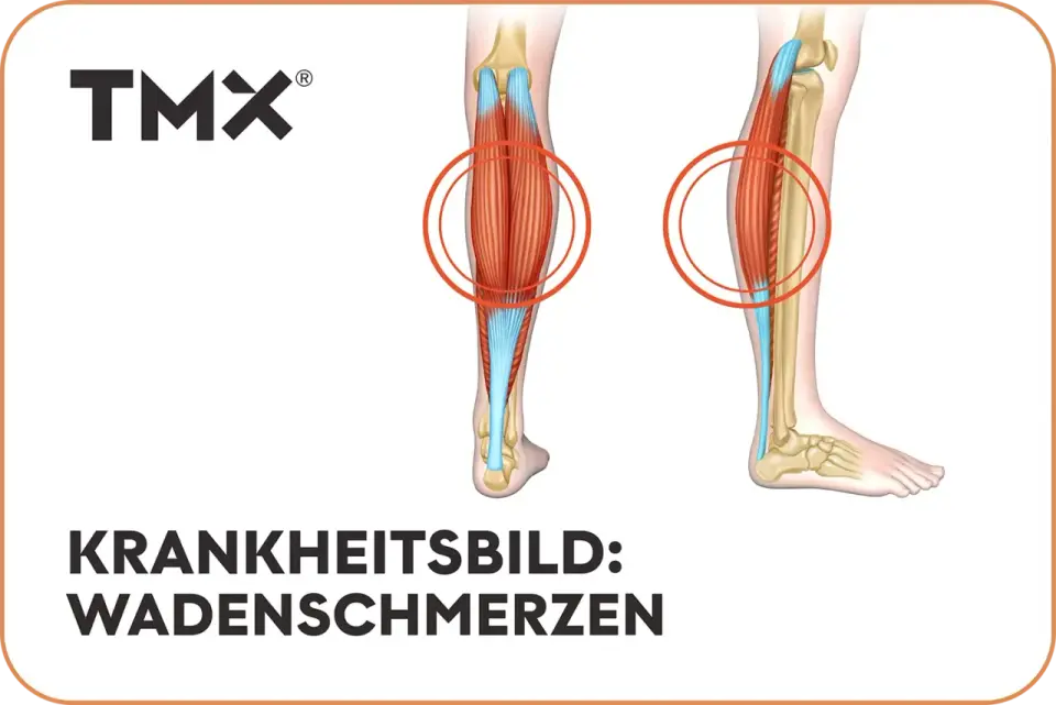 Wadenschmerzen - was dahintersteckt und wann es ernst wird
