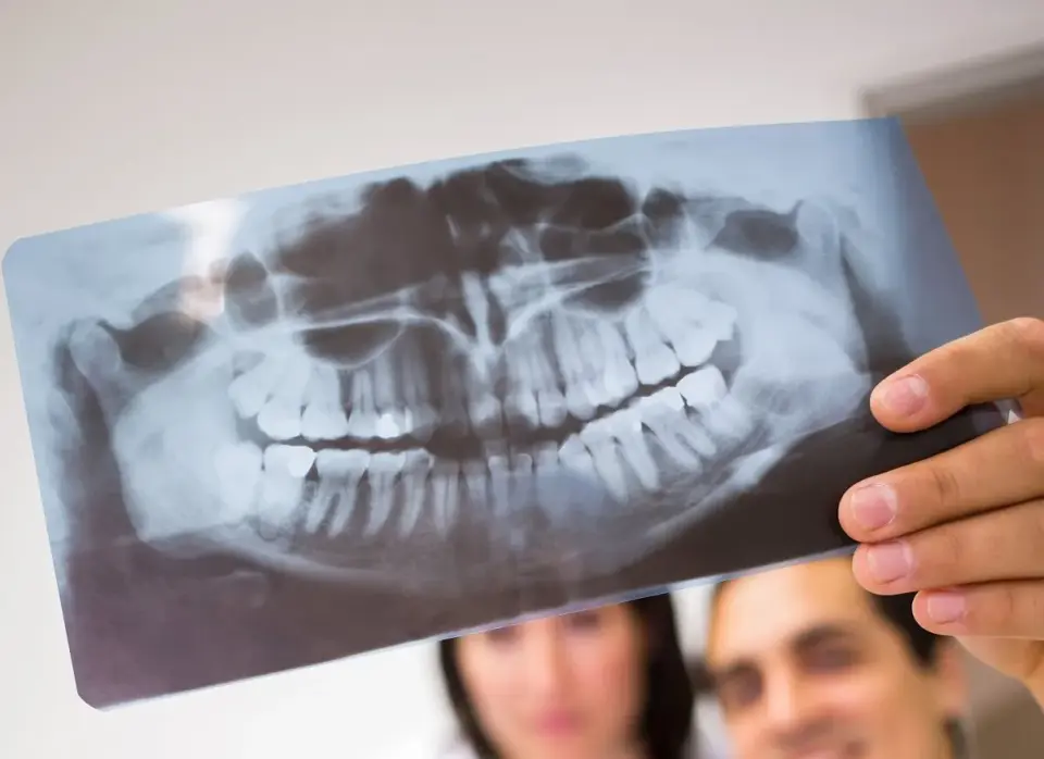 Badania radiograficzne w stomatologii - Czy zawsze potrzebne?
