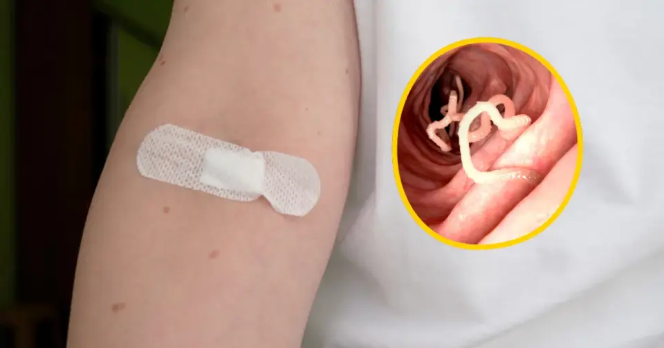 Czy masz pasożyty układu pokarmowego? Objawy, diagnostyka i leczenie