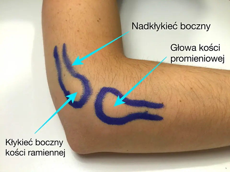 Łokieć tenisisty - jak wygląda diagnostyka i kiedy zrobić badania?