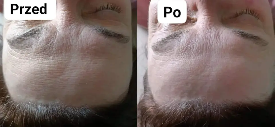 Zoga Face Integration - efekty, cena, porównanie. Warto?