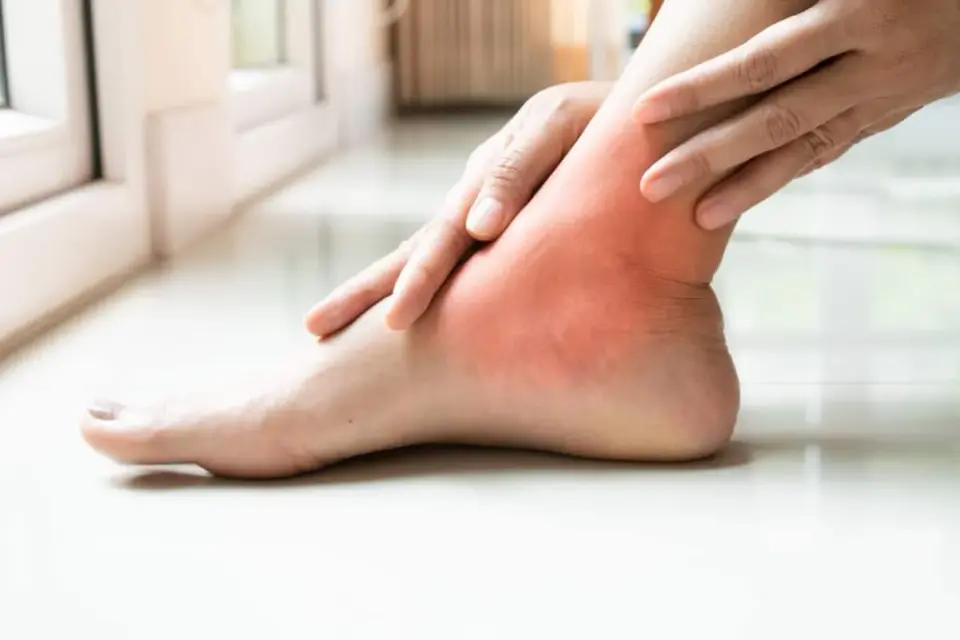 Palce stopy bolą? Deformacje, urazy i kiedy iść do ortopedy