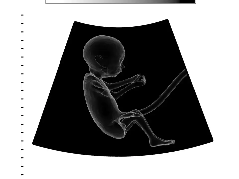 Hipotrofia płodu - kiedy mały płód wymaga pilnej kontroli?
