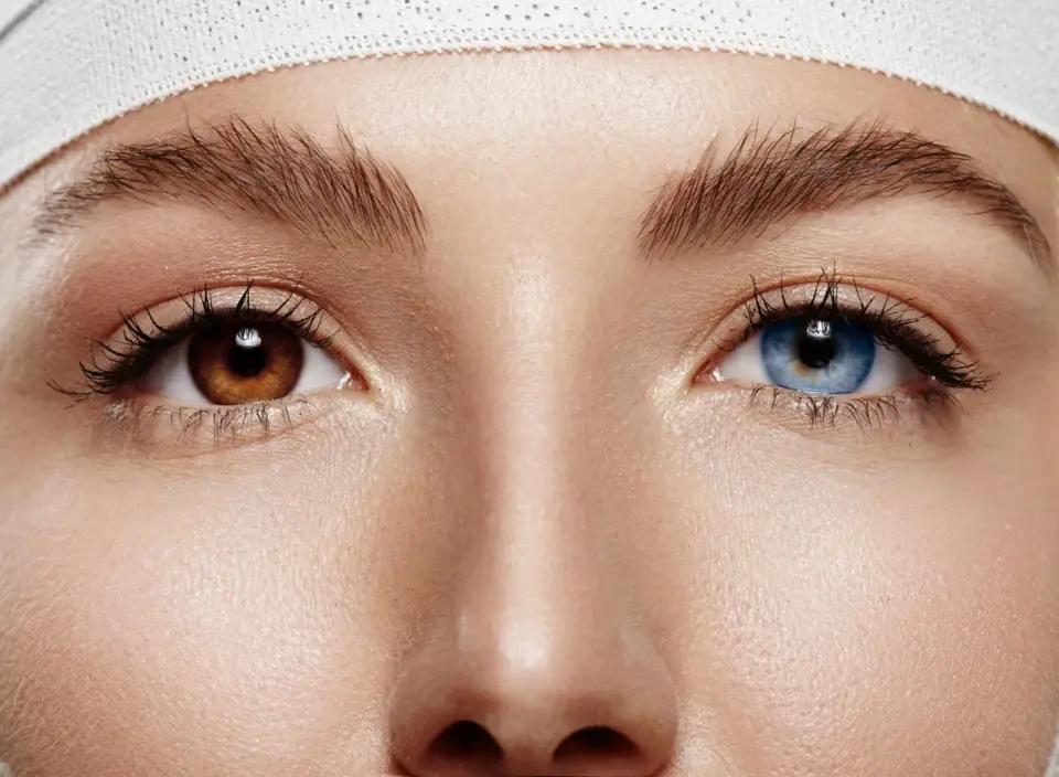 Heterochromia oka - kiedy różne kolory tęczówek są problemem?