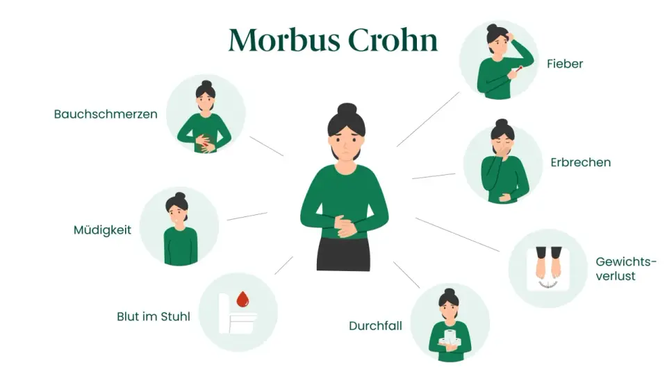 Morbus Crohn bei Frauen - die wichtigsten Anzeichen erkennen